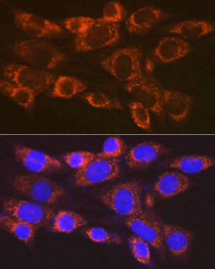 ARF1 Rabbit mAb