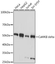 CaMKII delta Rabbit mAb