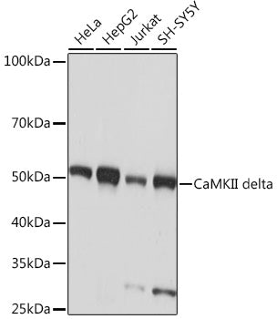 CaMKII delta Rabbit mAb