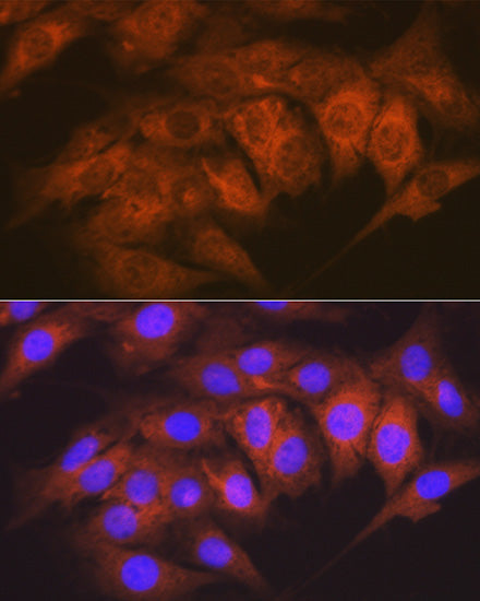 CaMKII delta Rabbit mAb