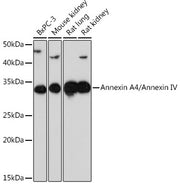 Annexin A4/Annexin IV Rabbit mAb
