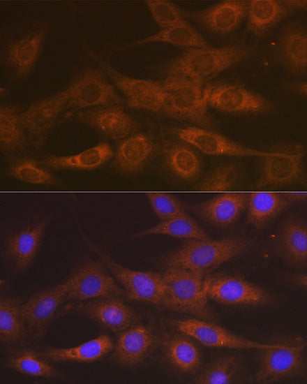[KO Validated] IMPDH2 Rabbit mAb