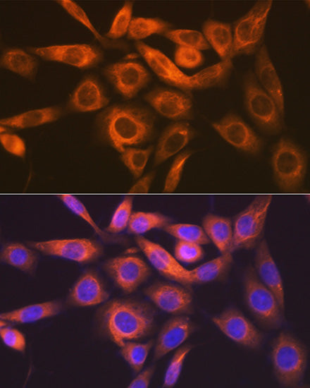 [KO Validated] IMPDH2 Rabbit mAb