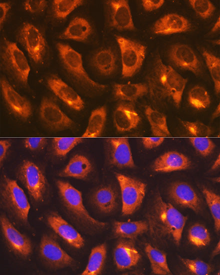 [KO Validated] IMPDH2 Rabbit mAb