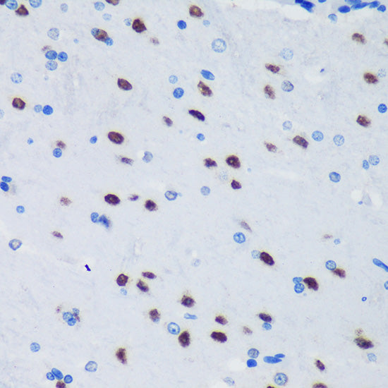 PSPC1 Rabbit pAb
