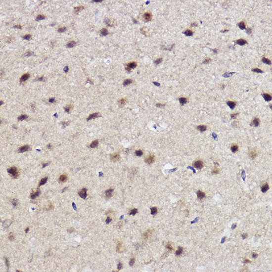 ALKBH1 Rabbit mAb