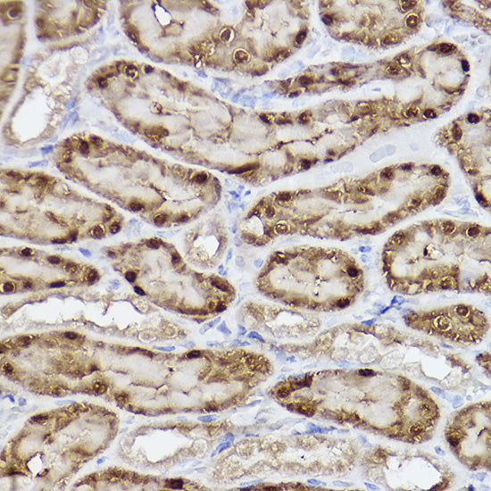 ALKBH1 Rabbit mAb