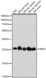 PIM2 Rabbit mAb