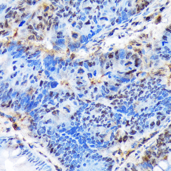 [KO Validated] CTIP1/BCL11A Rabbit mAb