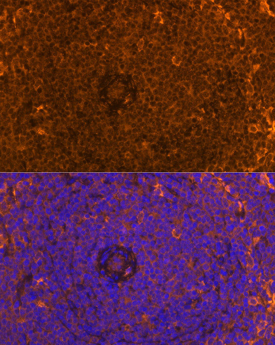FAM65B Rabbit pAb