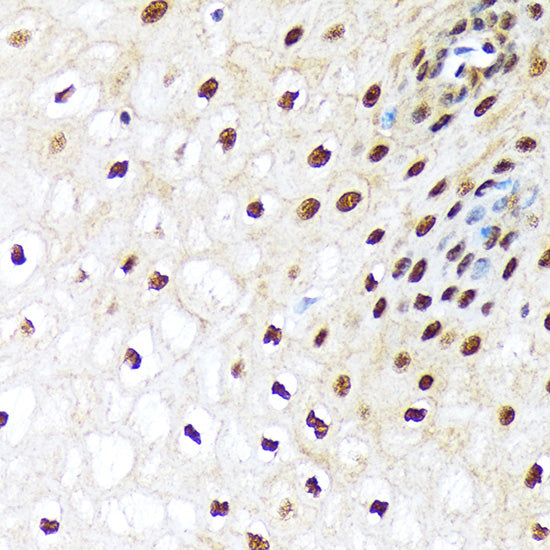 UBA1 Rabbit mAb