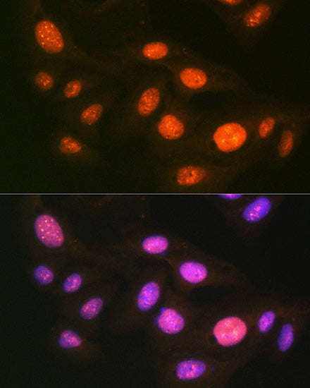UBA1 Rabbit mAb