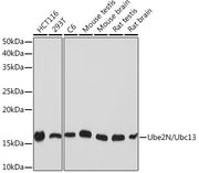 Ube2N/Ubc13 Rabbit mAb