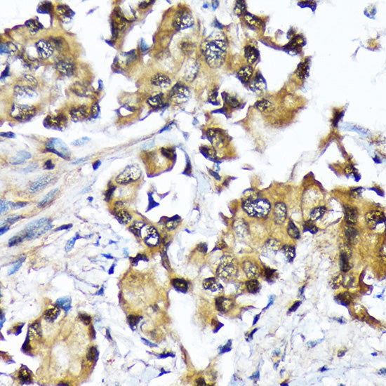 Ube2N/Ubc13 Rabbit mAb