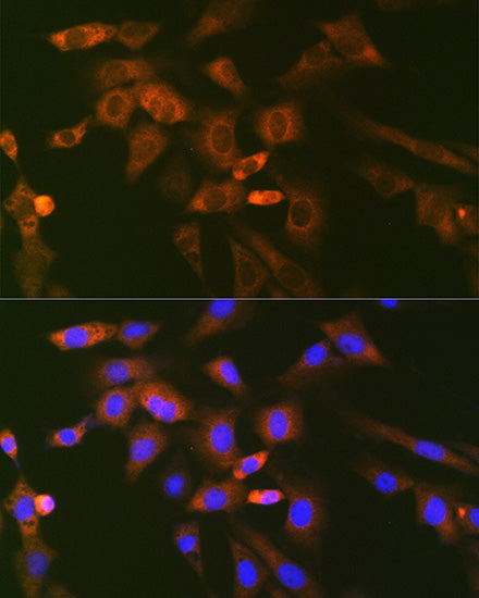 Ube2N/Ubc13 Rabbit mAb