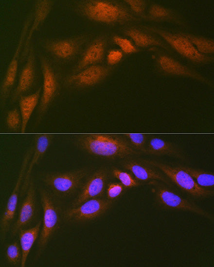 Ube2N/Ubc13 Rabbit mAb