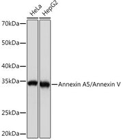 Annexin A5/Annexin V Rabbit mAb