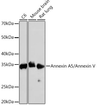 Annexin A5/Annexin V Rabbit mAb
