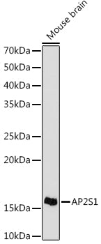 AP2S1 Rabbit mAb