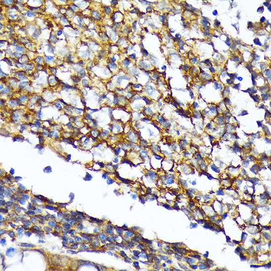 CD82 Rabbit mAb