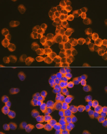 CD82 Rabbit mAb