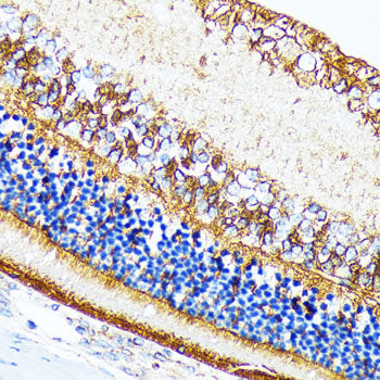 CRALBP Rabbit mAb