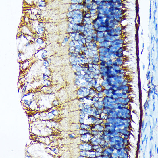 CRALBP Rabbit mAb