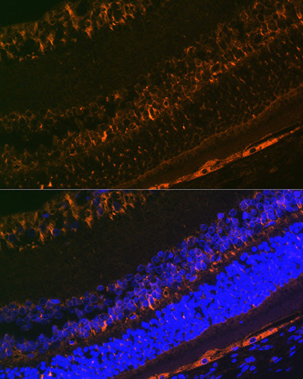 CRALBP Rabbit mAb