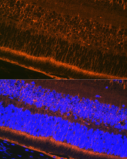 CRALBP Rabbit mAb