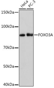 FOXO3A Rabbit mAb