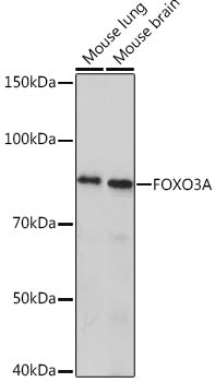 FOXO3A Rabbit mAb