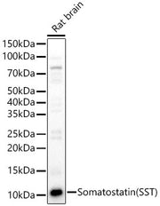 Somatostatin (SST) Rabbit pAb