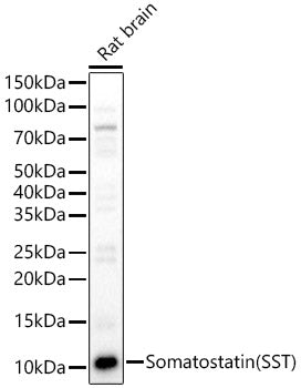 Somatostatin (SST) Rabbit pAb