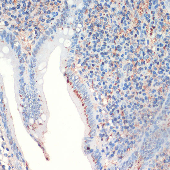 Somatostatin (SST) Rabbit pAb