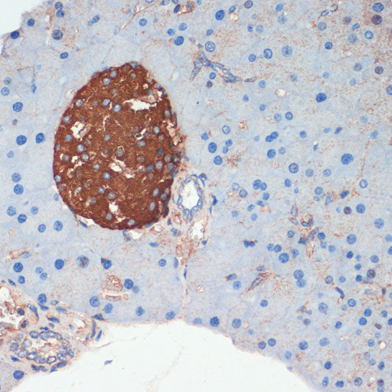 Somatostatin (SST) Rabbit pAb