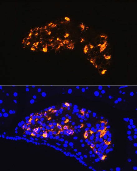 Somatostatin (SST) Rabbit pAb