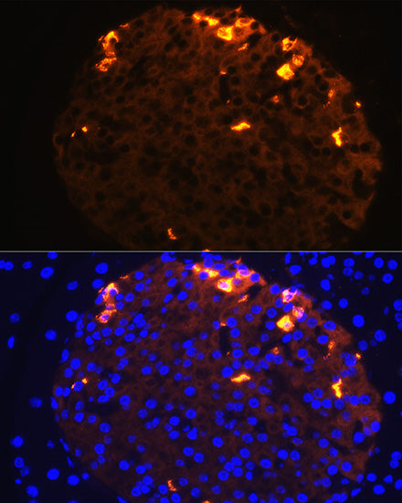 Somatostatin (SST) Rabbit pAb