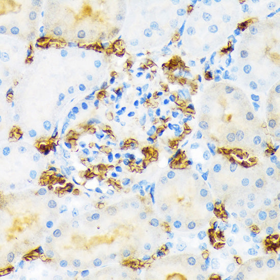 Hemoglobin subunit alpha (HBA1) Rabbit mAb