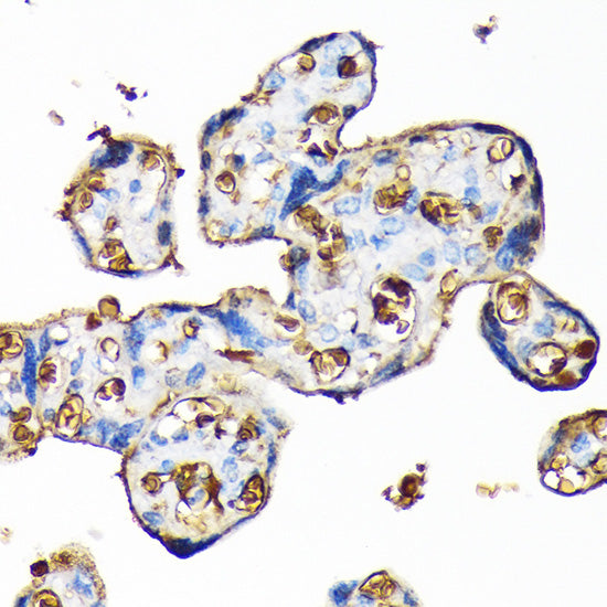 Hemoglobin subunit alpha (HBA1) Rabbit mAb