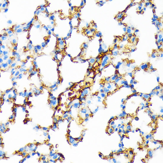 Hemoglobin subunit alpha (HBA1) Rabbit mAb