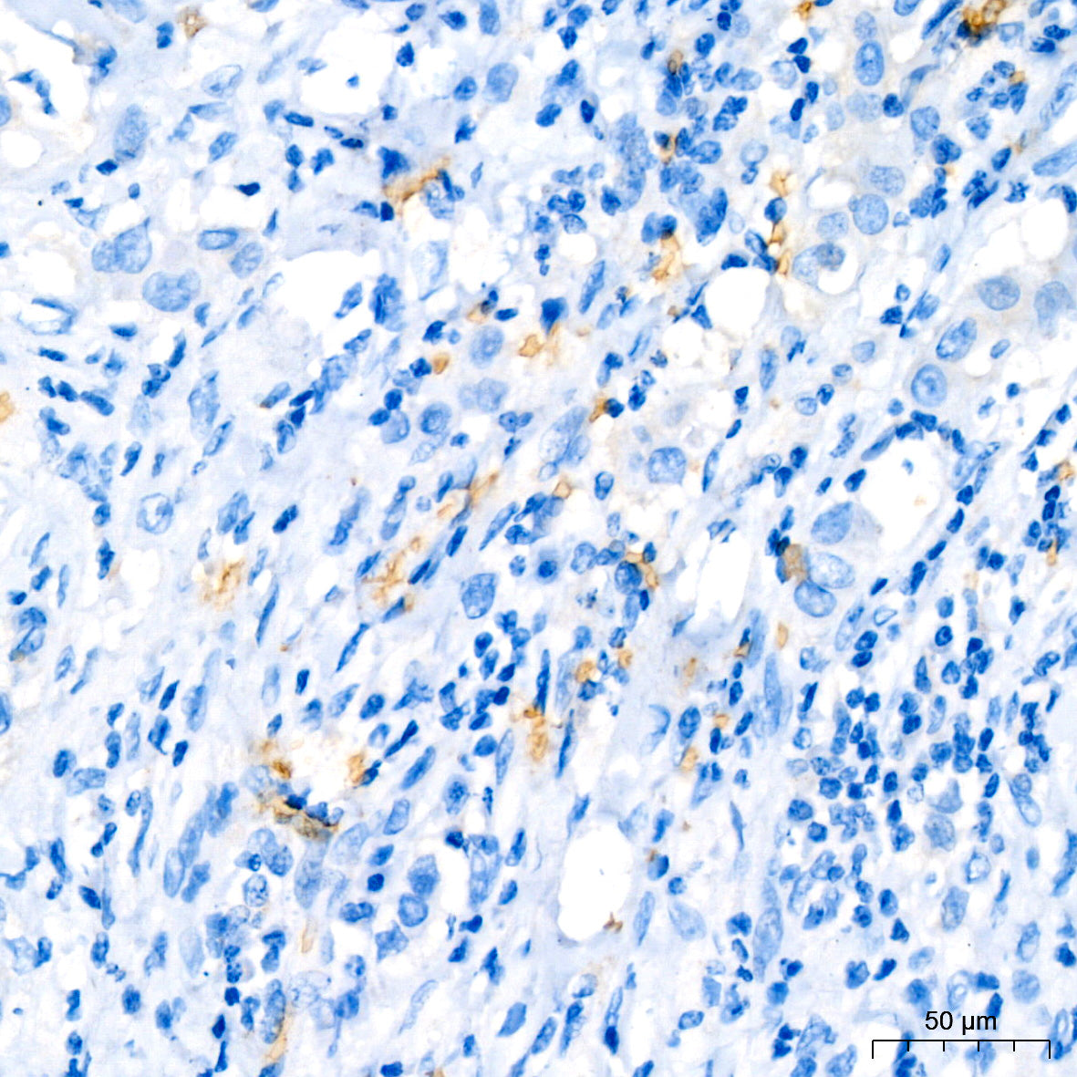 Hemoglobin subunit alpha (HBA1) Rabbit mAb