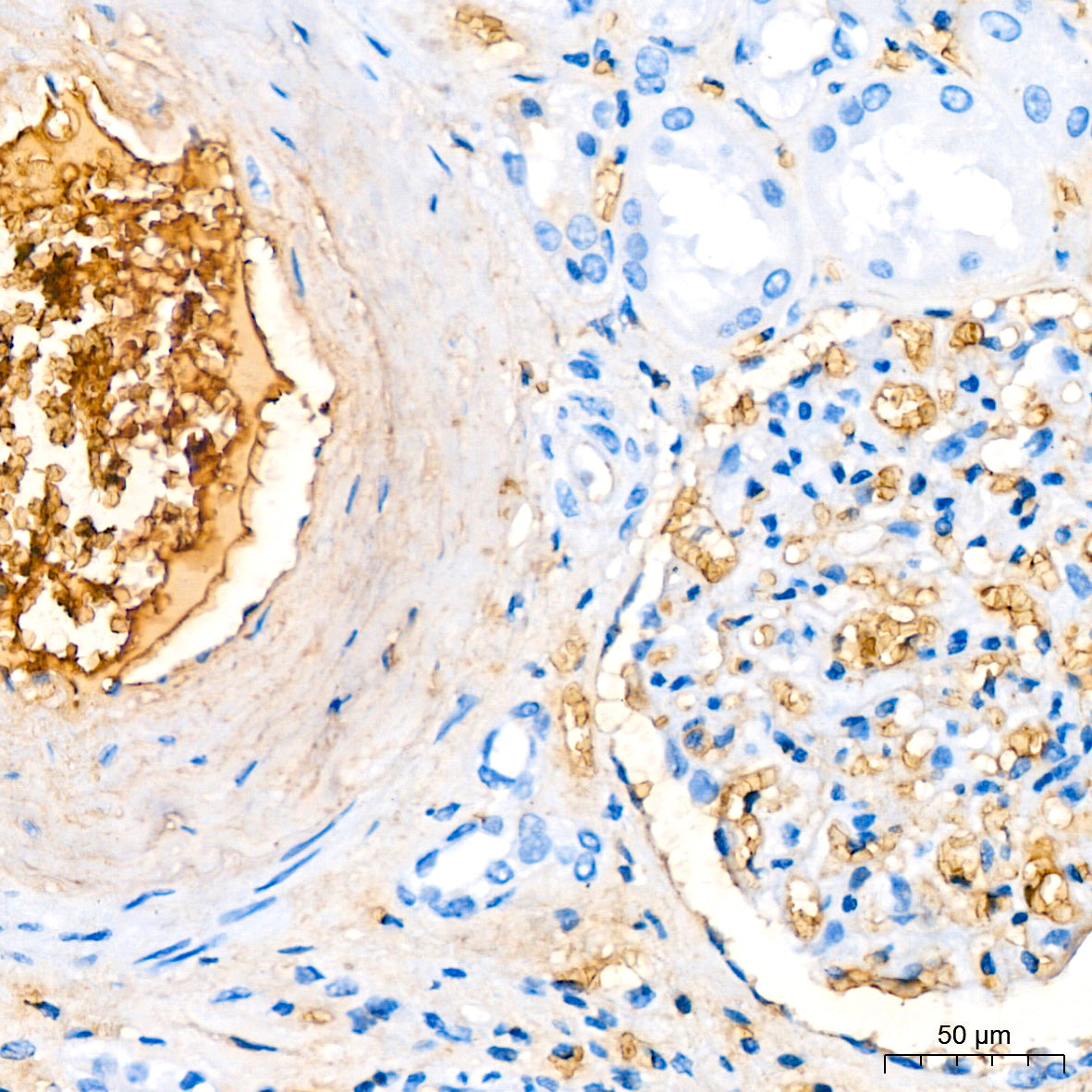 Hemoglobin subunit alpha (HBA1) Rabbit mAb
