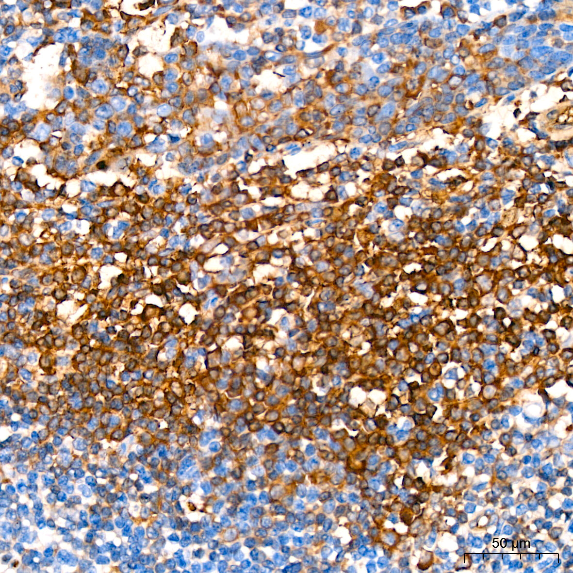 Hemoglobin subunit alpha (HBA1) Rabbit mAb