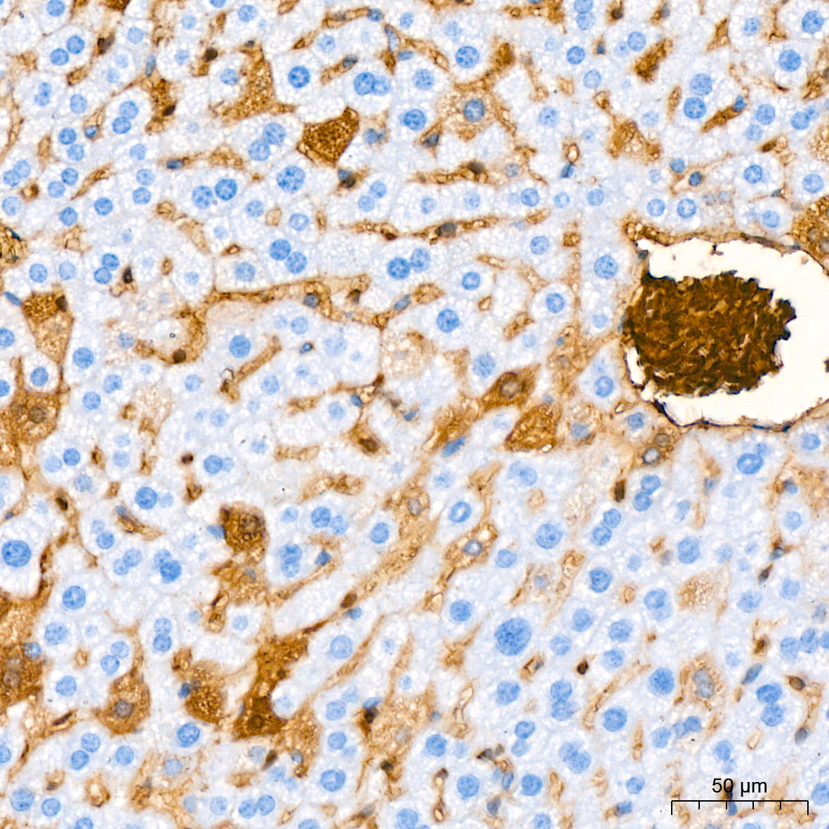 Hemoglobin subunit alpha (HBA1) Rabbit mAb
