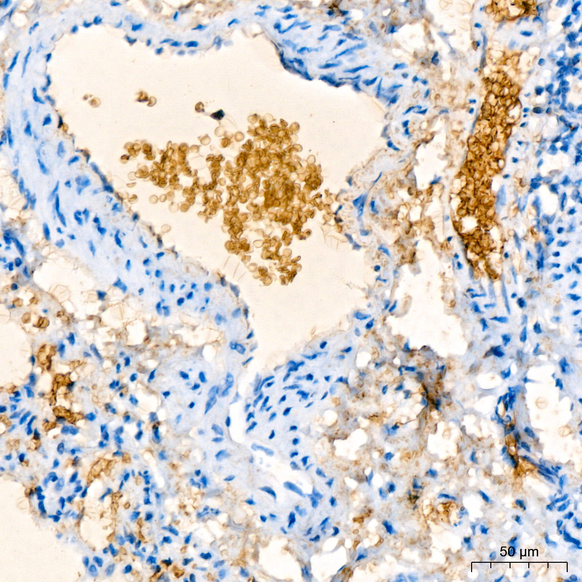 Hemoglobin subunit alpha (HBA1) Rabbit mAb