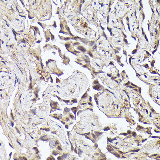 METTL4 Rabbit pAb