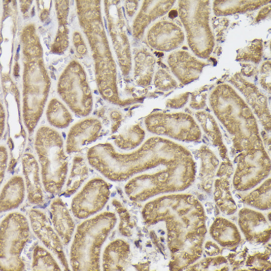 METTL4 Rabbit pAb