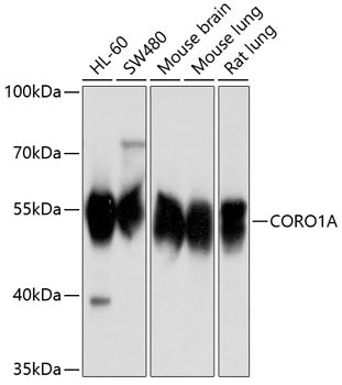 CORO1A Rabbit pAb