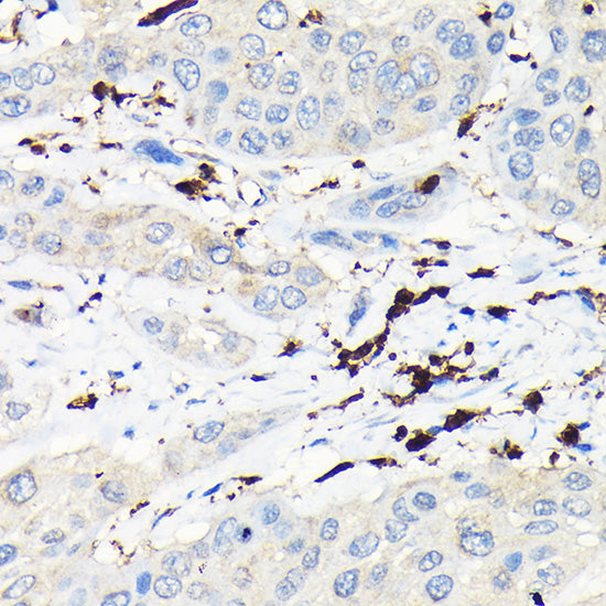 CORO1A Rabbit pAb
