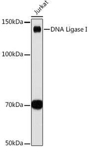 DNA Ligase I Rabbit mAb